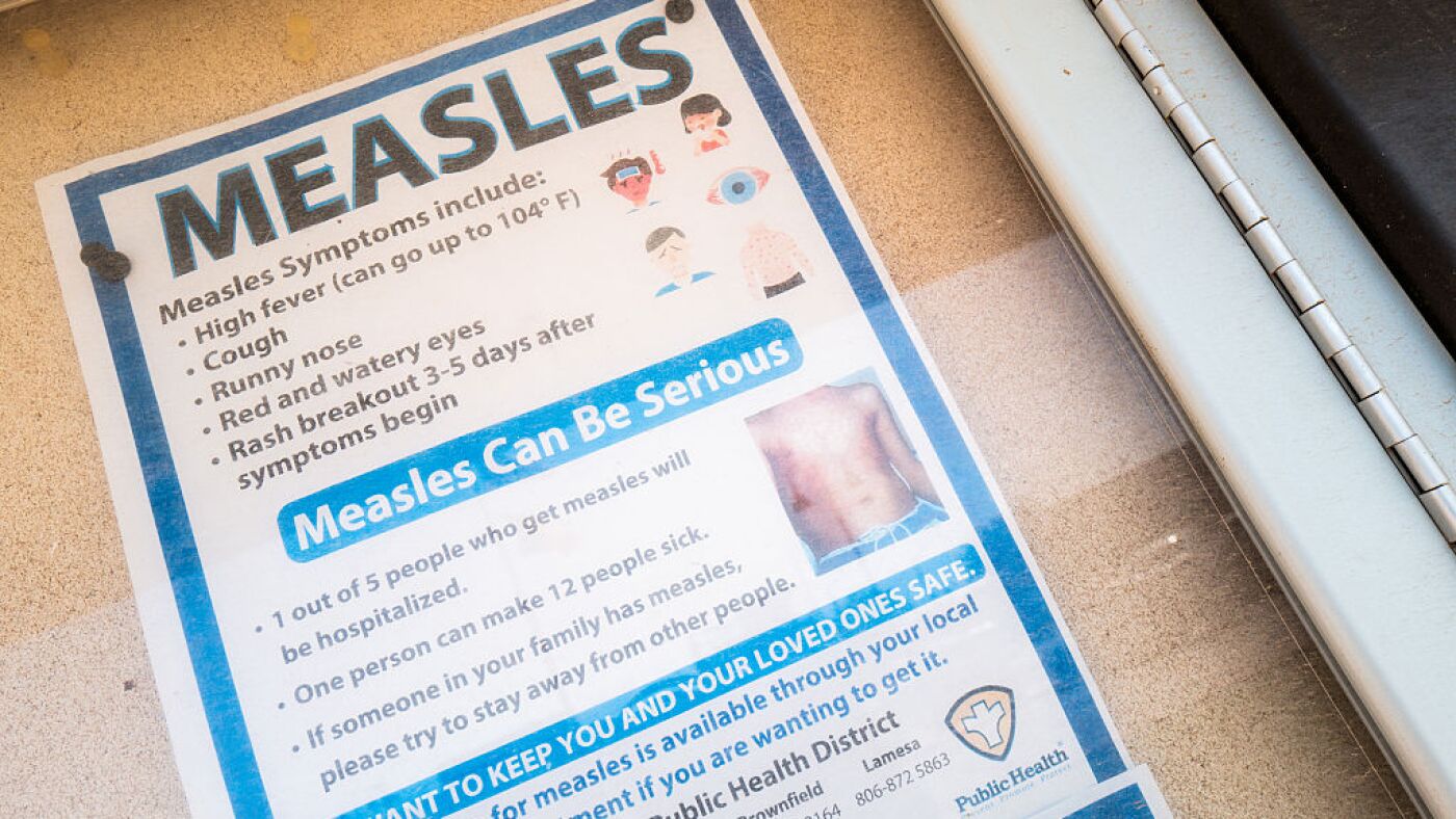 Measles math: What to find out about 1,001 measles instances throughout the nation : Photographs