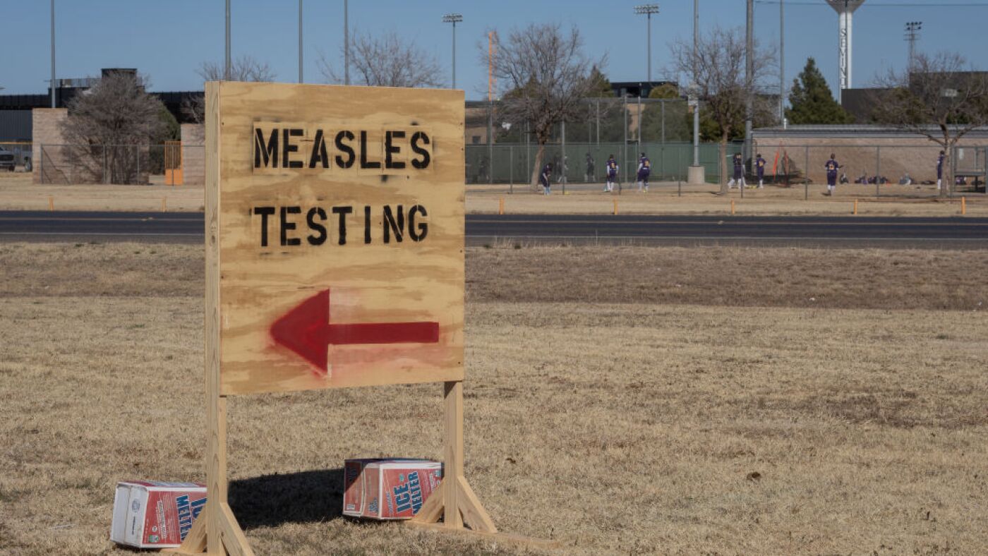 U.S. measles instances are the very best in 33 years, the CDC experiences : Pictures